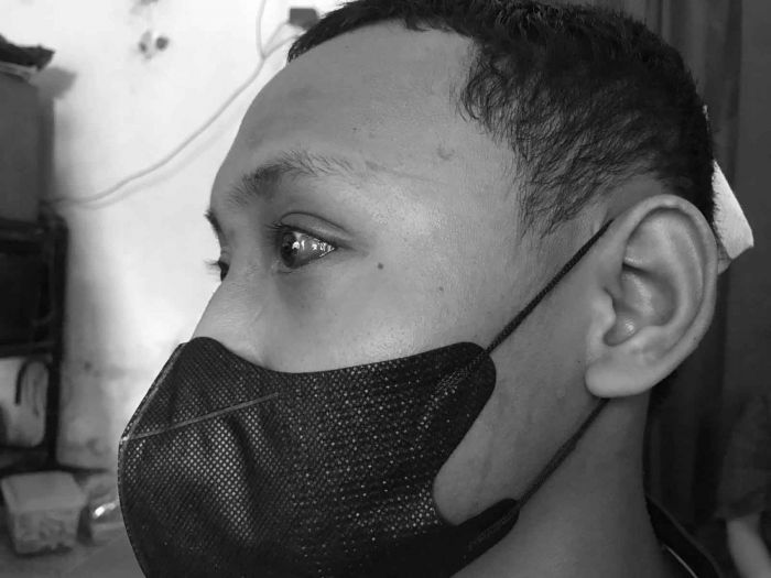 Kembali Berulah, Gangster di Sidoarjo Keroyok Remaja hingga Babak Belur Kembali Berulah, Gangster di Sidoarjo Keroyok Remaja hingga Babak Belur