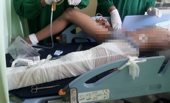 Kecelakaan di Prambon, Pelajar SMP Tabrak Truk Parkir hingga Sebabkan Patah Kaki