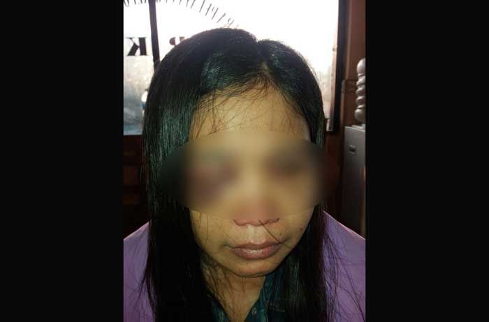 Hajar Istri hingga Babak Belur, Suami Ngaku Khilaf dan Nyesal Hajar Istri hingga Babak Belur, Suami Ngaku Khilaf dan Nyesal