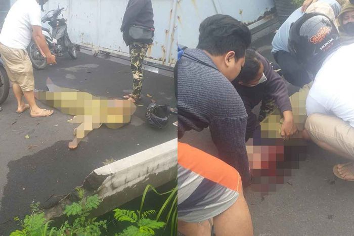 Gagal Menyalip, Kaki Seorang Pelajar asal Surabaya Remuk Terlindas Truk di Waru Sidoarjo Gagal Menyalip, Kaki Seorang Pelajar asal Surabaya Remuk Terlindas Truk di Waru Sidoarjo