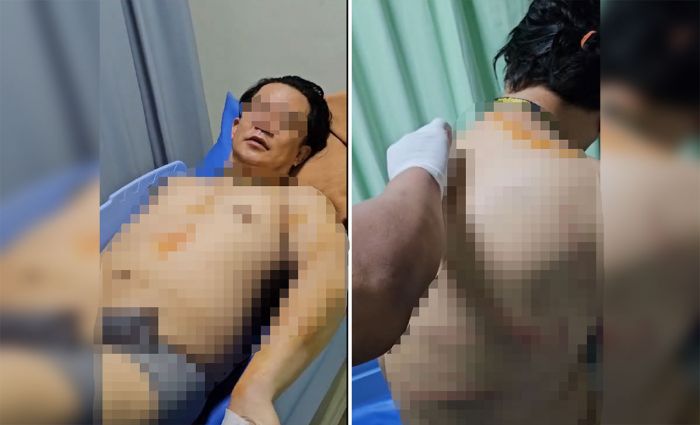 Dugaan KDRT Mantan Istri Terhadap Mantan Suami, Kasatreskrim: Masih Kita Lidik Dugaan KDRT Mantan Istri Terhadap Mantan Suami, Kasatreskrim: Masih Kita Lidik