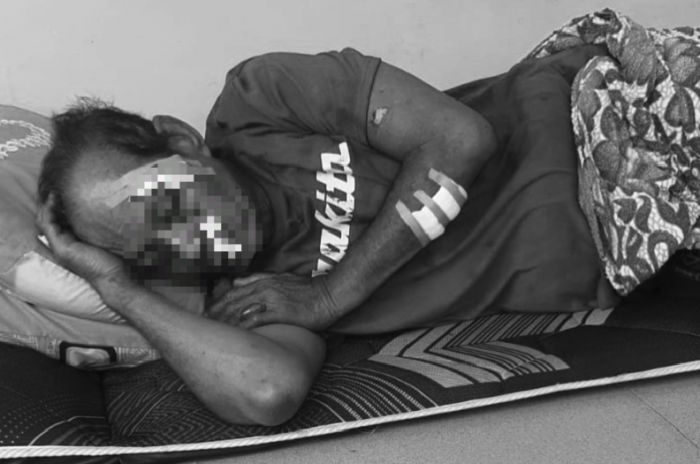 Lansia di Sampang Dianiaya Tetangga hingga Luka Serius