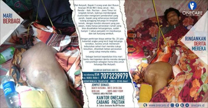 Derita Mulyadi Warga Bandar Pacitan, Kakinya Bengkak dan Berdarah Akibat Tumor Ganas Derita Mulyadi Warga Bandar Pacitan, Kakinya Bengkak dan Berdarah Akibat Tumor Ganas