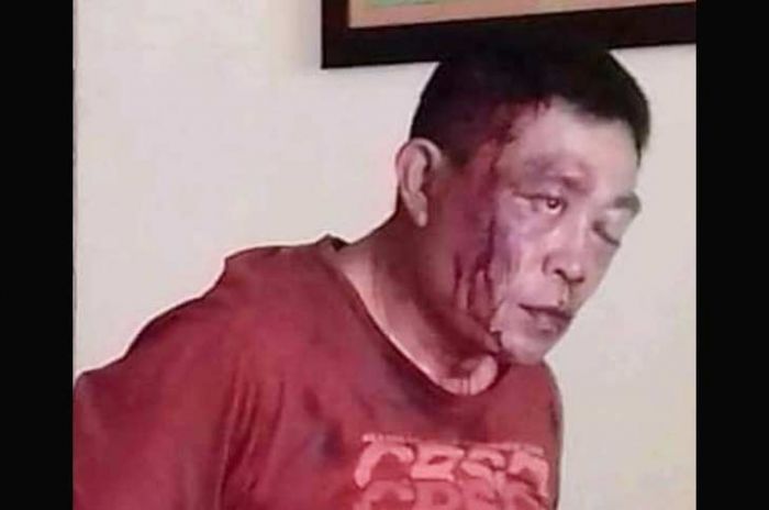 Begal Bersajam Dimassa di Tumpang Begal Bersajam Dimassa di Tumpang