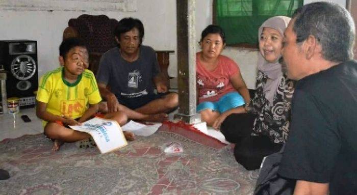 Bocah di Tulungagung Derita Tumor Jinak, Tak Sekolah Bocah di Tulungagung Derita Tumor Jinak, Tak Sekolah