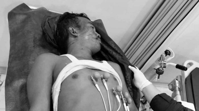 Pekerja Proyek Diduga Tewas Terjatuh di Area Pembangunan Ponpes Dalwa Pasuruan