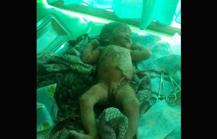 Dikira Ular, Ternyata yang Terbungkus Daun Jati Ini Bayi Perempuan Dikira Ular, Ternyata yang Terbungkus Daun Jati Ini Bayi Perempuan