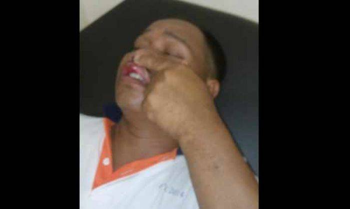 Dituduh Robek Stiker Paslon, Anggota Linmas KPPS di Situbondo Dianiaya Dituduh Robek Stiker Paslon, Anggota Linmas KPPS di Situbondo Dianiaya