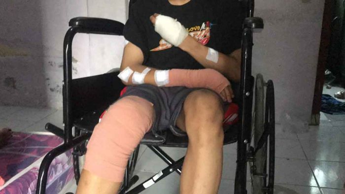 Hendak Pulang Nongkrong, Seorang Pemuda di Sidoarjo Dikeroyok Segerombolan Orang Bersenjata Tajam Hendak Pulang Nongkrong, Seorang Pemuda di Sidoarjo Dikeroyok Segerombolan Orang Bersenjata Tajam