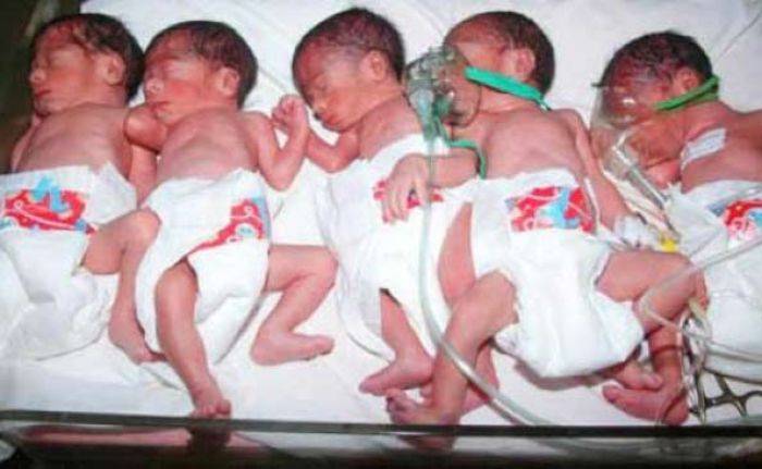 Bayi Kembar Lima di Surabaya Diperiksa dan Dirawat Khusus, Berpotensi Gagal Multi Organ Bayi Kembar Lima di Surabaya Diperiksa dan Dirawat Khusus, Berpotensi Gagal Multi Organ