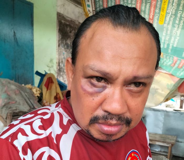 Wartawan Memorandum di Pamekasan Jadi Korban Kekerasan saat Pejalanan Menuju Tempat Liputan Wartawan Memorandum di Pamekasan Jadi Korban Kekerasan saat Pejalanan Menuju Tempat Liputan