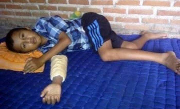 Oknum TNI di Nganjuk Aniaya Siswa MTs Hingga Patah Tangan Oknum TNI di Nganjuk Aniaya Siswa MTs Hingga Patah Tangan