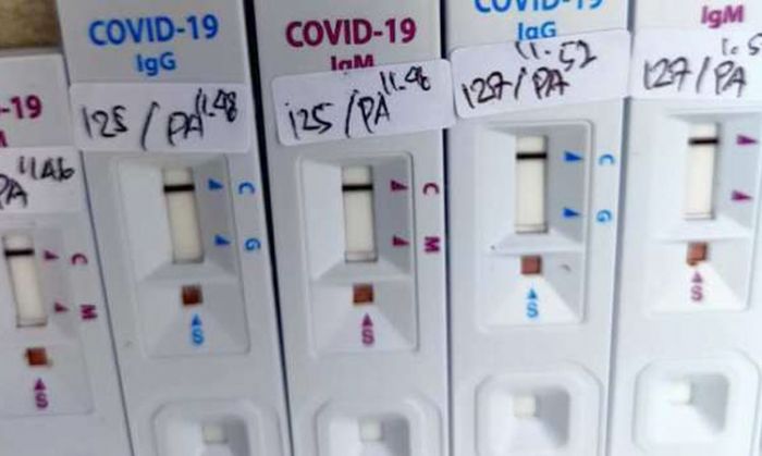 Hasil Rapid Test 12 Santri Ponpes Temboro Asal Pacitan Dinyatakan Reaktif Covid-19 Hasil Rapid Test 12 Santri Ponpes Temboro Asal Pacitan Dinyatakan Reaktif Covid-19