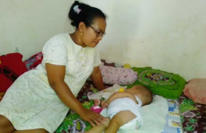 Balita Penderita Hydrocephalus Asal Kerek Butuh Uluran Tangan