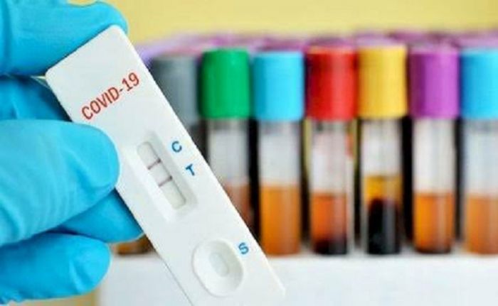 Hasil Rapid Test Puluhan Santri Temboro Asal Pacitan, Mayoritas Non Reaktif