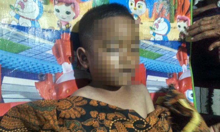 Berangkat Ngaji, Bocah Kedungsekar Gresik Tewas Tenggelam di Telaga