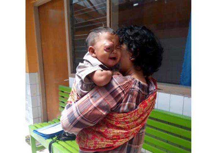 Balita Penderita Tumor di Magetan Berharap Bisa Segera Dioperasi Balita Penderita Tumor di Magetan Berharap Bisa Segera Dioperasi