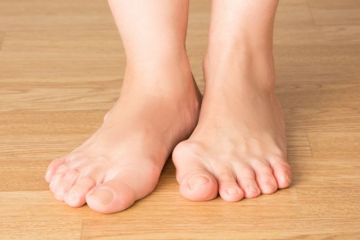 Kenali 5 Pemicu Nyeri Asam Urat Kenali 5 Pemicu Nyeri Asam Urat