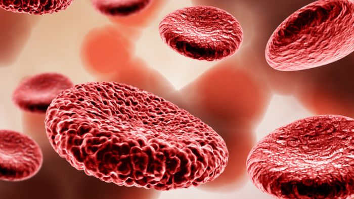 Cara Mencegah Anemia Aplastik Cara Mencegah Anemia Aplastik