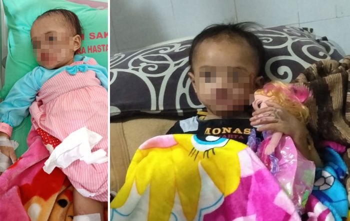 Bayi 2,5 Tahun di Kota Batu Dianiaya Calon Suami Ibunya: Disiram Minyak Panas, Dipukul, Bibir Sobek