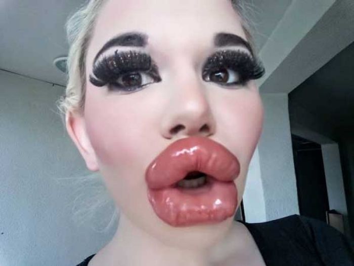 Menurut Anda, Ini Perempuan Waras apa Ndak? Dia Bangga Punya Bibir Terjontor di Dunia Menurut Anda, Ini Perempuan Waras apa Ndak? Dia Bangga Punya Bibir Terjontor di Dunia