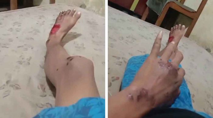 Gangster Bacok Jukir di Surabaya, Polisi Belum Terima Laporan