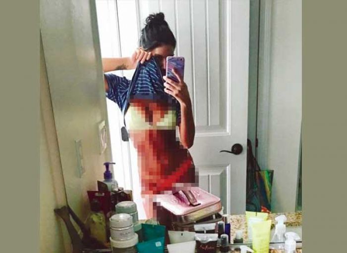 Dibully di Medsos, Bintang Film Porno August Ames Kendat di Pohon Taman Dibully di Medsos, Bintang Film Porno August Ames Kendat di Pohon Taman