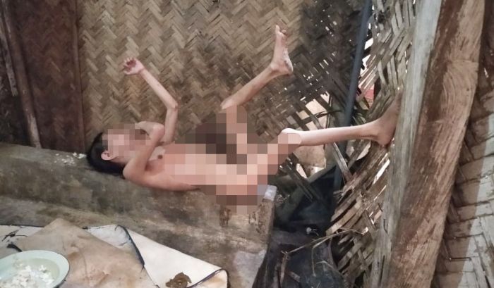 Penghasilan Sehari-hari Hanya Rp 30 ribu, Tetap Berjuang Merawat Dua Anaknya yang Disabilitas Penghasilan Sehari-hari Hanya Rp 30 ribu, Tetap Berjuang Merawat Dua Anaknya yang Disabilitas