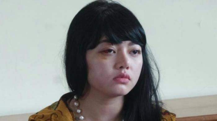 Ngaku Ditonjok Dua Kali oleh Masinton, Dita Langsung Pusing, Mata Berkunang-Kunang Ngaku Ditonjok Dua Kali oleh Masinton, Dita Langsung Pusing, Mata Berkunang-Kunang