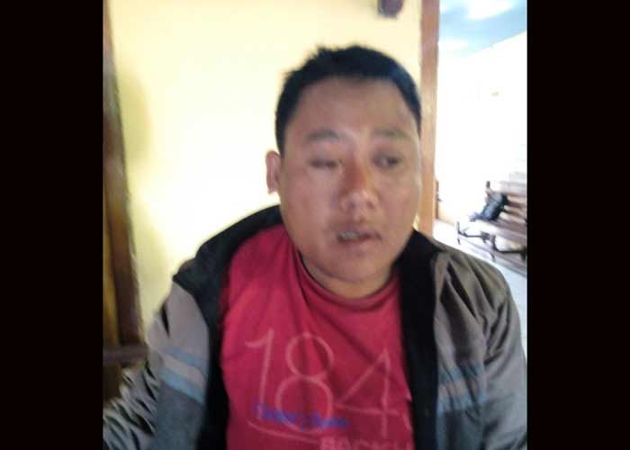 Curi Obat Rumput, Pemuda di Semanding Bonyok Dihajar Warga Curi Obat Rumput, Pemuda di Semanding Bonyok Dihajar Warga