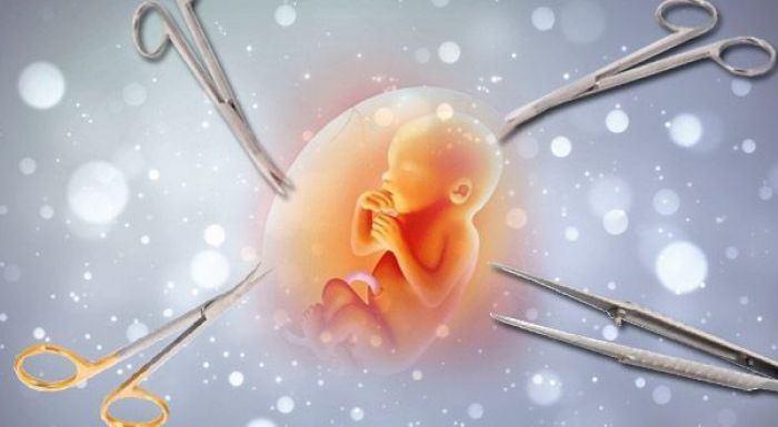 Amnesti Internasional Legalkan Aborsi Amnesti Internasional Legalkan Aborsi