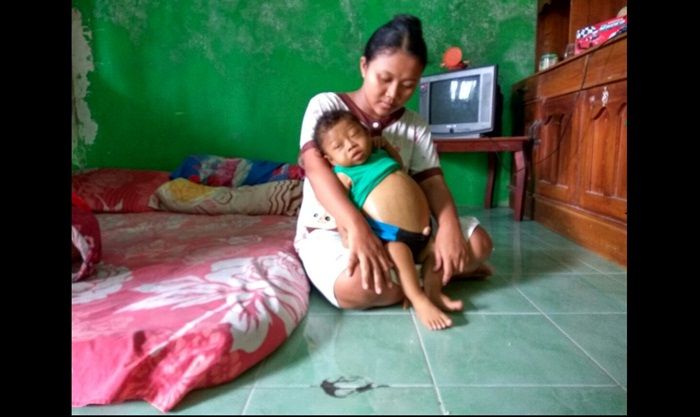 Balita Pengidap Penyakit Gagal Hati di Taman Sidoarjo Butuh Uluran Tangan Balita Pengidap Penyakit Gagal Hati di Taman Sidoarjo Butuh Uluran Tangan