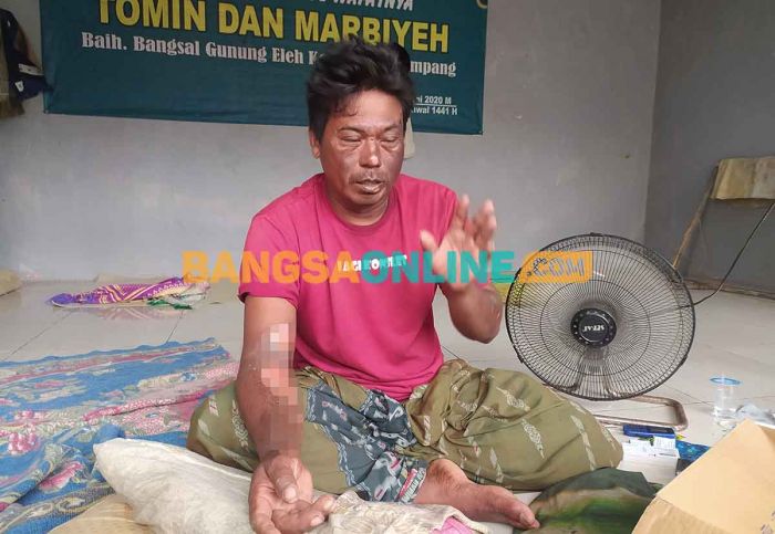 Ini Cerita Korban Terbakar Semburan Api dari Sumur Bor di Sampang Ini Cerita Korban Terbakar Semburan Api dari Sumur Bor di Sampang