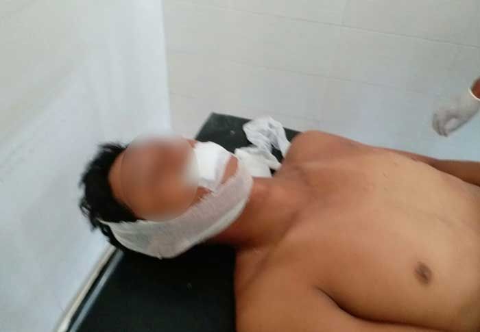 Lagi, Galian Tambang Batu Kumbung di Tuban Memakan Korban Jiwa Lagi, Galian Tambang Batu Kumbung di Tuban Memakan Korban Jiwa