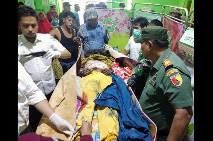 Pemecah Batu di Pamekasan Tewas Terkena Bomnya Sendiri Pemecah Batu di Pamekasan Tewas Terkena Bomnya Sendiri