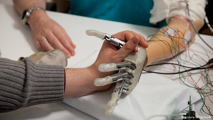 Ditemukan, Tangan Bionik yang Bisa Merasa