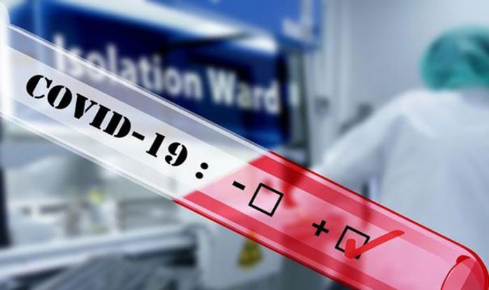 Enam Anak terpapar Covid-19 tapi Sehat, Total Positif Virus Corona di Situbondo 75 Orang Enam Anak terpapar Covid-19 tapi Sehat, Total Positif Virus Corona di Situbondo 75 Orang