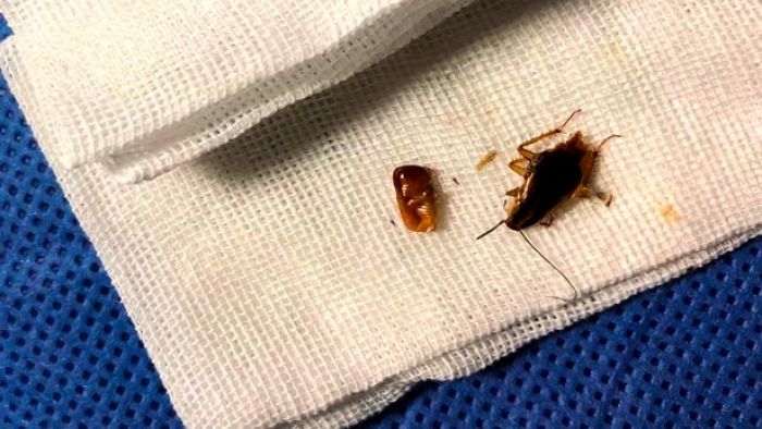 Waspada, Kecoak Bisa Bertelur dan Menetas dalam Telinga Waspada, Kecoak Bisa Bertelur dan Menetas dalam Telinga