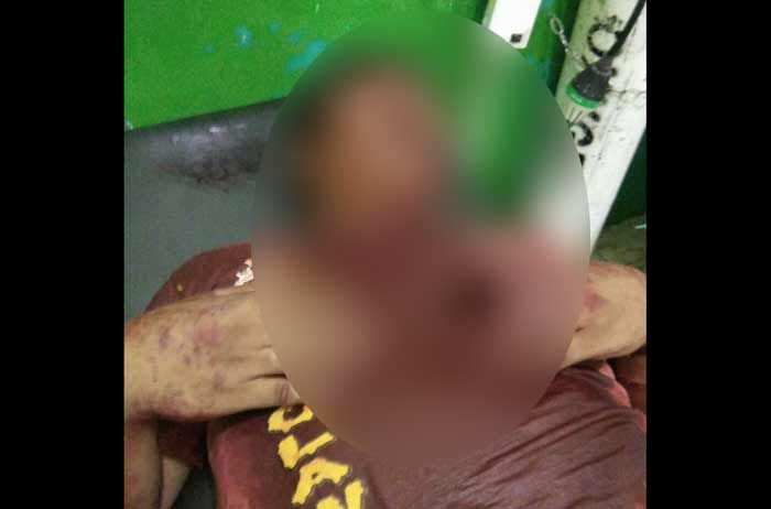 Cekcok, Bapak dan Anak Warga Tambakboyo Kompak Bacok Pemuda Jenu Cekcok, Bapak dan Anak Warga Tambakboyo Kompak Bacok Pemuda Jenu
