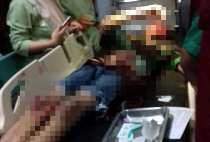 Hendak Ngopi, Tiga Karyawan di Pasuruan Dibondet, Satu Tewas