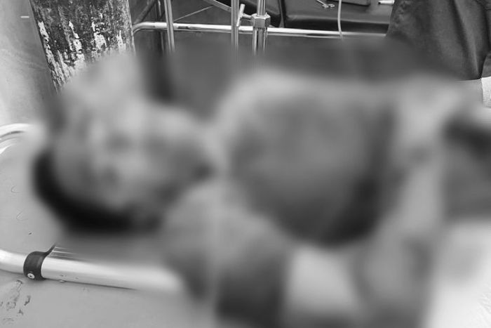 Warga Pamekasan Bacok Tetangga Kosnya di Bangkalan, Pelaku Diburu Polisi