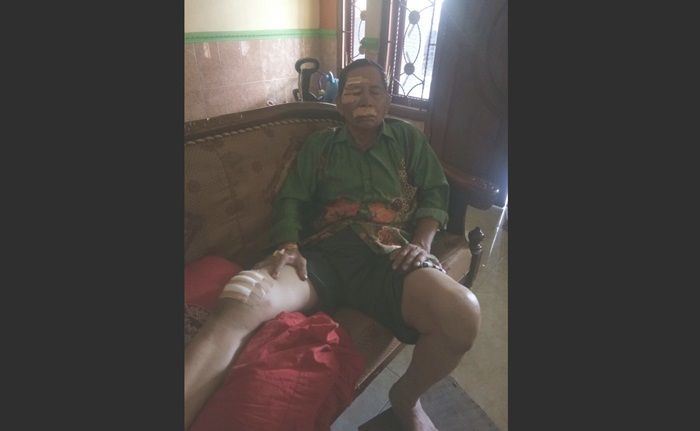 Kena Begal, Pasutri Warga Porong Sidoarjo Alami Luka di Sekujur Tubuh