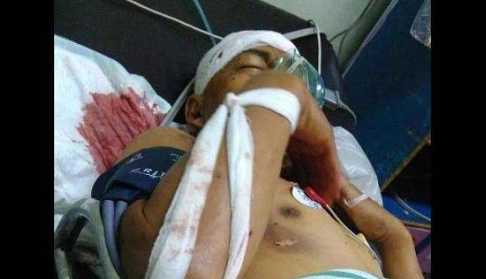 Petir Sambar Poncokusumo Malang, Satu Keluarga Dilarikan ke Rumah Sakit