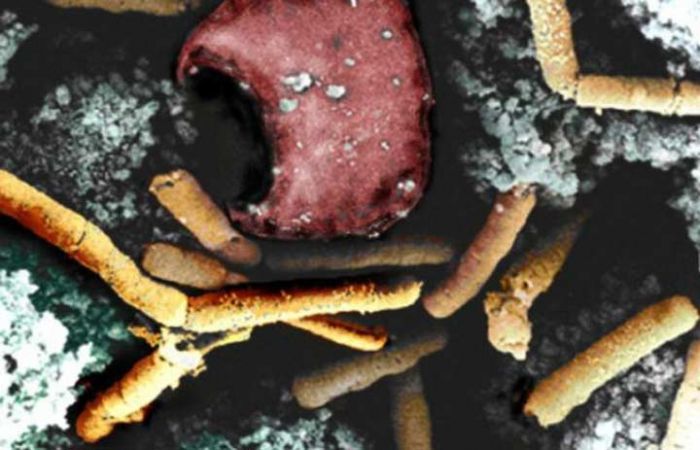 Dinkes Pacitan Pastikan Tujuh Pasien Positif Terinfeksi Ringan Bakteri Antraks