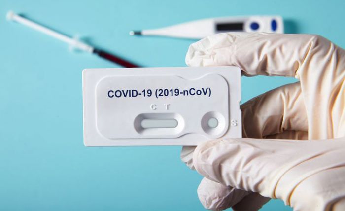 Hasil Rapid Test 34 Warga Gemaharjo, Semuanya Negatif Covid-19 Hasil Rapid Test 34 Warga Gemaharjo, Semuanya Negatif Covid-19