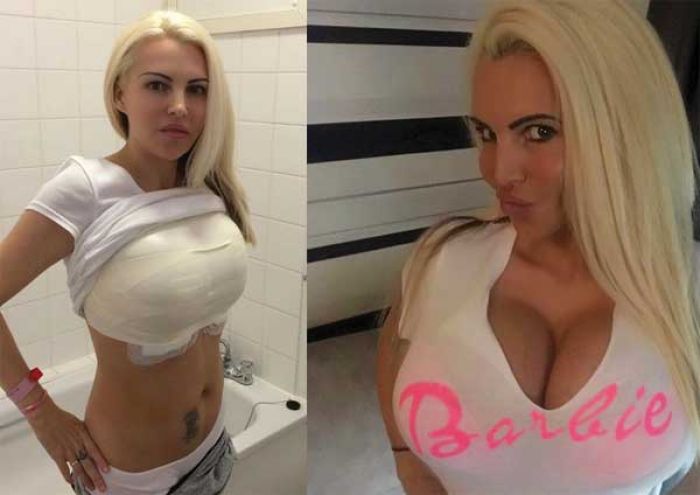 Cewek Model Ini Terobsesi Jadi Pamella Anderson, Termasuk Ukuran Buah Dada Cewek Model Ini Terobsesi Jadi Pamella Anderson, Termasuk Ukuran Buah Dada