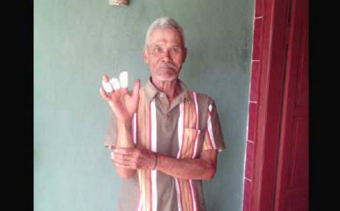 Pergi Melaut, Dua Jemari Tangan Nelayan Pacitan Putus Terpotong Baling-baling Pergi Melaut, Dua Jemari Tangan Nelayan Pacitan Putus Terpotong Baling-baling