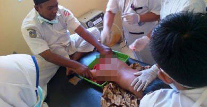 Kera Liar Serang Perkampungan di Situbondo, Gigit Seorang Balita Kera Liar Serang Perkampungan di Situbondo, Gigit Seorang Balita