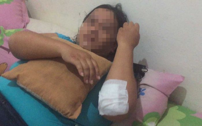 Diduga Jadi Korban Kecelakaan, Wanita di Jalan Undaan Wetan Surabaya Ternyata Korban Jambret Diduga Jadi Korban Kecelakaan, Wanita di Jalan Undaan Wetan Surabaya Ternyata Korban Jambret