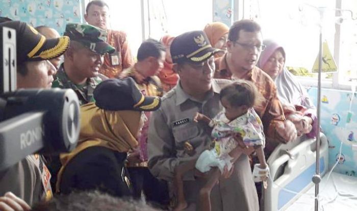 Bupati Fadeli Minta Penanganan Balita Penderita Gizi Buruk Diprioritaskan Bupati Fadeli Minta Penanganan Balita Penderita Gizi Buruk Diprioritaskan